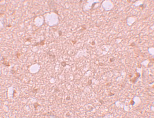 Immunohistochemistry Solo Antibody - BSA Free