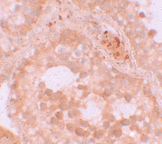 Immunohistochemistry WDR92 Antibody - BSA Free
