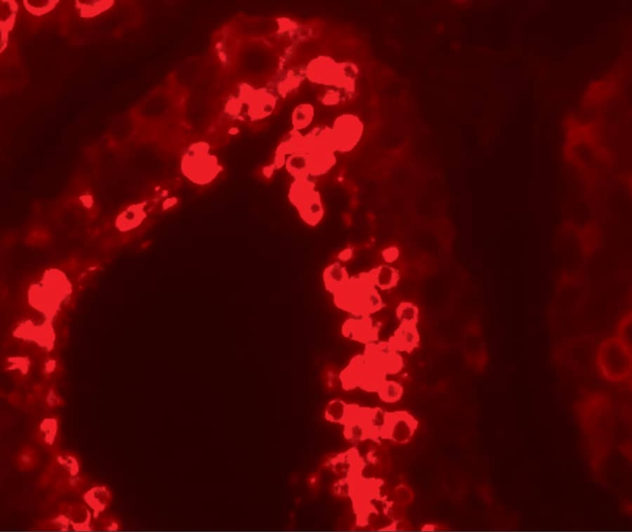 Immunocytochemistry/ Immunofluorescence MSY2 Antibody - BSA Free