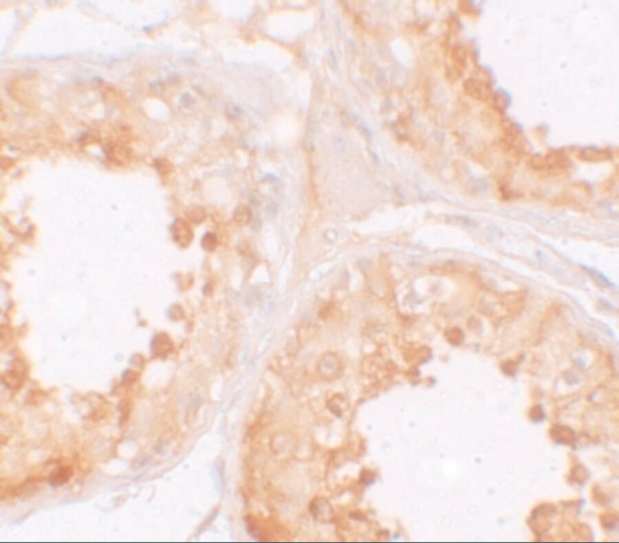 Immunohistochemistry: MSY2 Antibody - BSA Free [NBP1-76283] - Immunohistochemistry of MSY2 in human testis tissue with MSY2 antibody at 10 ug/mL.