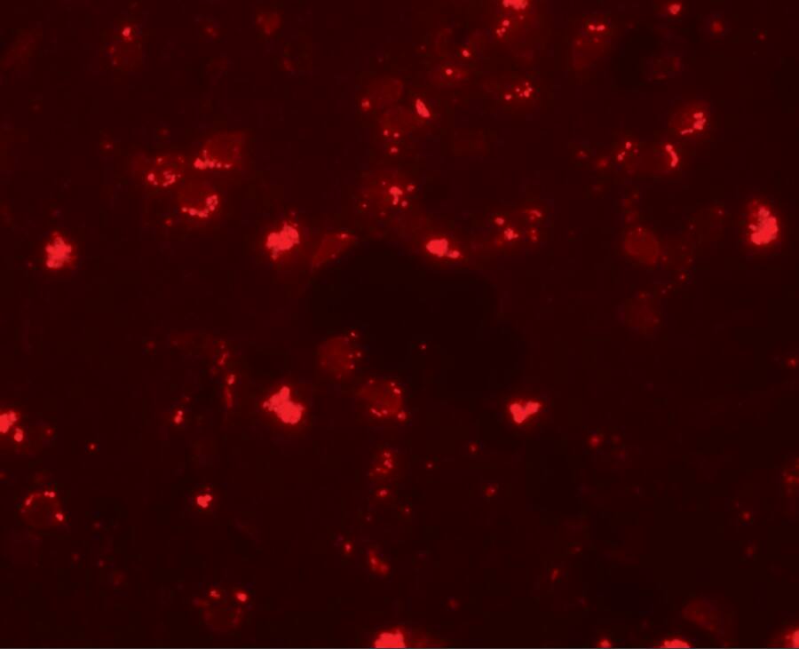 Immunocytochemistry/ Immunofluorescence: SH3RF2 Antibody - BSA Free [NBP1-76284] - Immunofluorescence of SH3RF2 in human brain tissue with SH3RF2 antibody at 20 u/mL.
