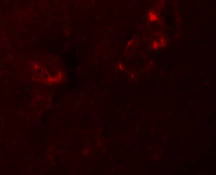 Immunocytochemistry/ Immunofluorescence: NLRP5 Antibody - BSA Free [NBP1-76289] - Immunofluorescence of NLRP5 in human brain tissue with NLRP5 antibody at 20 u/mL.