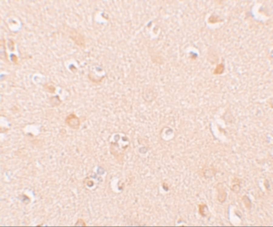 Immunohistochemistry NLRP5 Antibody - BSA Free