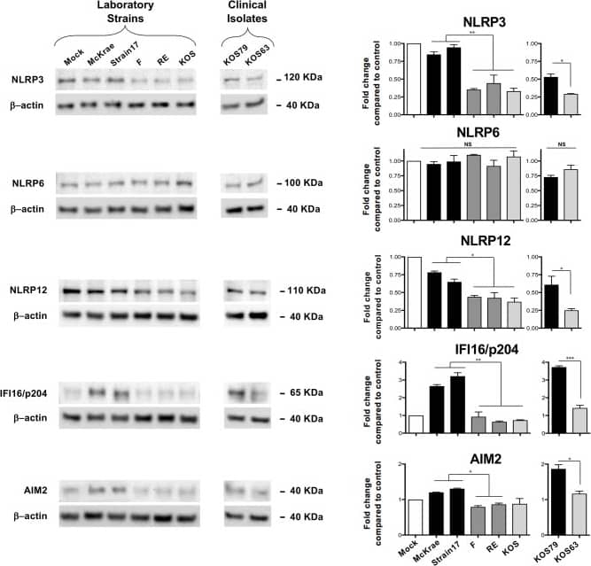 Western Blot: NALP12 Antibody - BSA Free [NBP1-76293] - Expression levels of NLRP3, NLRP6, NLRP12, IFI16/p204, & AIM2 inflammasomes in mouse corneas following infection with virulent & less-virulent strains of HSV-1. B6 mice (n = 6) were infected ocularly with 2.5 × 105 pfu/eye of HSV-1 laboratory strains McKrae, 17, F, RE or KOS or with clinical isolates KOS79 & KOS63. Mock-infected mice (n = 6) were used as controls. Forty-eight hours post-infection animals were euthanized the corneas were excised & homogenized in lysis buffer, & western blot was performed for expression of NLRP3, NLRP6, NLRP12, IFI16/p204, & AIM2. Corresponding  beta -actin was used as a control. Three western blot were performed using three different corneal lysates harvested from three sets of corneas pooled from 2 infected mice (i.e., 4 corneas per lysate). Results are representative of those three independent experiments. Graphs (mean plus SD) show fold change in expression of NLRP3, NLRP6, NLRP12, IFI16/p204, & AIM2 at 48 h post-infection with virulent/less-virulent strains of HSV-1 compared to the control & normalized to  beta -actin. Representative densitometric analysis is shown compared to control. *P < 0.05; **P < 0.01; ***P < 0.001 using Student's t test. Image collected & cropped by CiteAb from the following publication (//pubmed.ncbi.nlm.nih.gov/31367214), licensed under a CC-BY license. Not internally tested by Novus Biologicals.