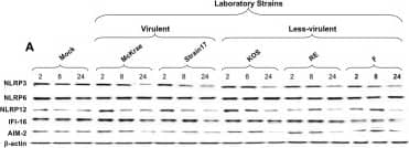 Western Blot: NALP12 Antibody - BSA Free [NBP1-76293] - Expression level of NLRP3, NLRP6, NLRP12, IFI16 & AIM2 inflammasomes in human primary corneal epithelial cells infected with virulent & less-virulent strains of HSV-1. Human primary corneal epithelial cells (hTCEpi cell line) were infected in vitro with HSV-1 laboratory strains McKrae, 17, F, RE or KOS (A,B) or with clinical isolates KOS79 & KOS63 (C,D) at MOI of 1. Two, 8 & 24 h post-infection, hTCEpi cells were harvested & immunoblots of whole cell lysates were performed for expression of NLRP3, NLRP6, NLRP12, IFI16, & AIM2 inflammasomes. Corresponding  beta -actin was used as a control. (B,D) Graphs show the kinetics of fold changes in NLRP3, NLRP6, NLRP12, IFI16, & AIM2 inflammasomes expression at 2, 8, & 24 h post-infection with virulent/less-virulent strains of HSV-1 compared to the control & normalized to  beta -actin. Results are representative of three experiments. Image collected & cropped by CiteAb from the following publication (//pubmed.ncbi.nlm.nih.gov/31367214), licensed under a CC-BY license. Not internally tested by Novus Biologicals.