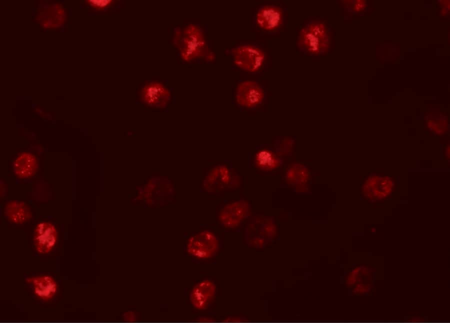 Immunocytochemistry/ Immunofluorescence: NLRP13 Antibody - BSA Free [NBP1-76294] - Immunofluorescence of NLRP13 in K562 cells with NLRP13 antibody at 20 u/mL.