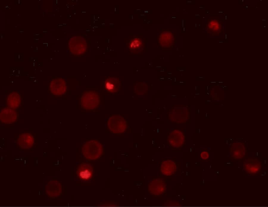 Immunocytochemistry/ Immunofluorescence: Importin alpha 3/KPNA4 Antibody - BSA Free [NBP1-76300] - Immunofluorescence of Importin alpha 3/KPNA4 in HeLa cells with Importin alpha 3/KPNA4 antibody at 20 u/mL.