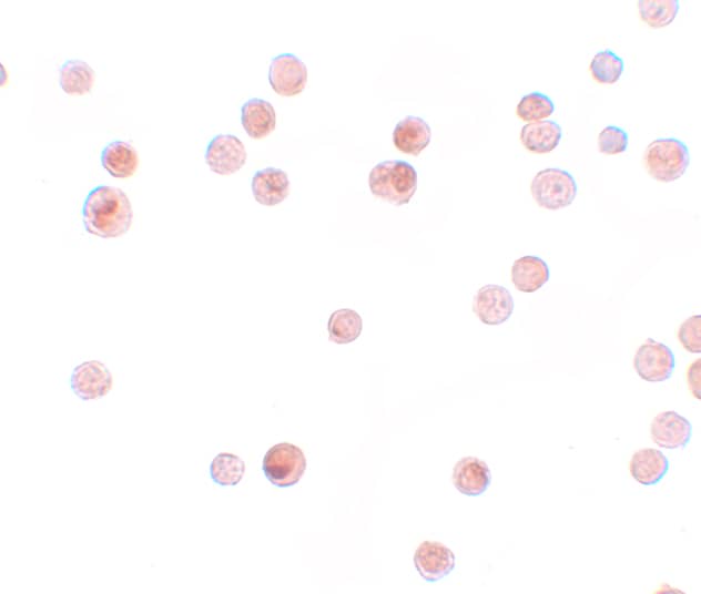 Immunocytochemistry/ Immunofluorescence: Importin alpha 3/KPNA4 Antibody - BSA Free [NBP1-76300] - Immunocytochemistry of Importin alpha 3/KPNA4 in HeLa cells with Importin alpha 3/KPNA4 antibody at 2.5 u/mL.