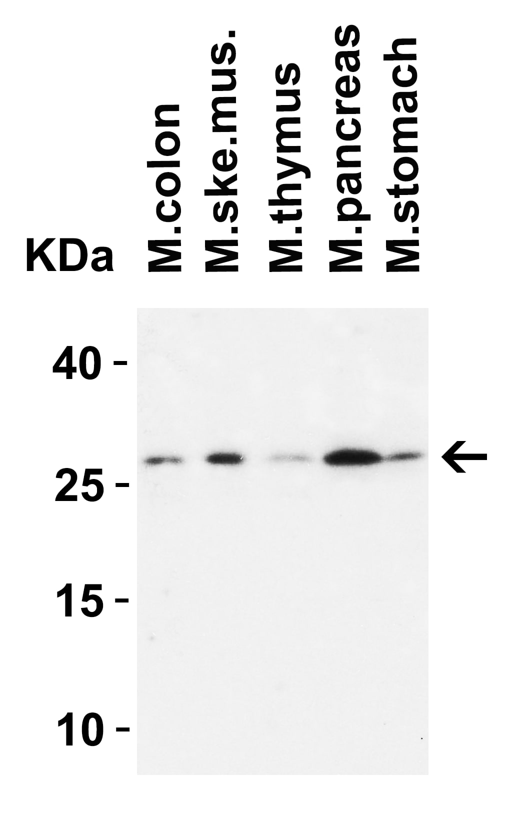 Western Blot MOX1 Antibody - BSA Free