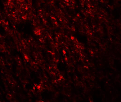 Immunocytochemistry/ Immunofluorescence: Staufen Antibody - BSA Free [NBP1-76303] - Immunofluorescence of Staufen in Human Brain cells with Staufen antibody at 20 u/mL.