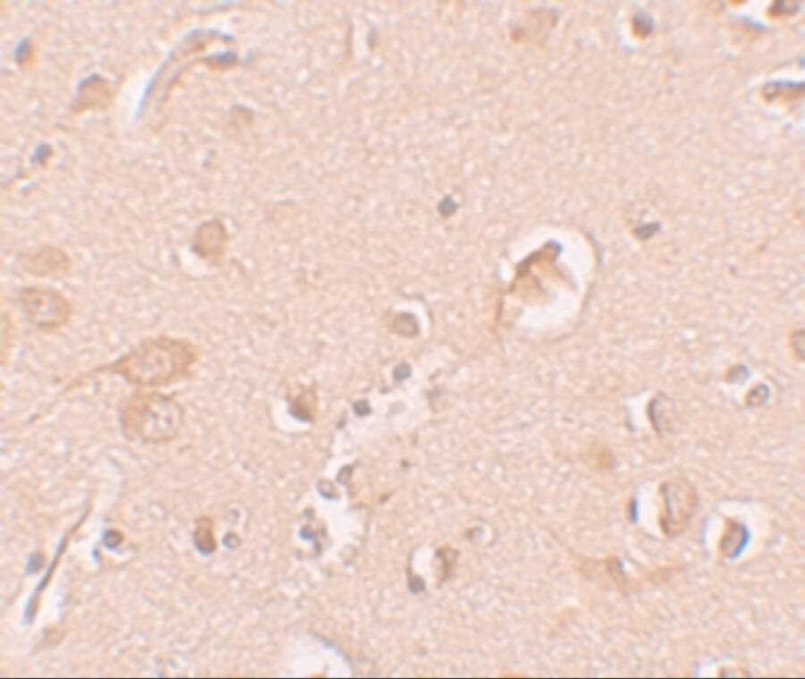 Immunohistochemistry: Staufen Antibody - BSA Free [NBP1-76303] - Immunohistochemistry of Staufen in human brain tissue with Staufen antibody at 10 u/mL.