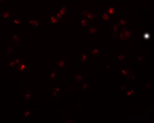 Immunocytochemistry/ Immunofluorescence: TRIP6 Antibody - BSA Free [NBP1-76305] - Immunofluorescence of TRIP6 in HeLa cells with TRIP6 antibody at 20 u/mL.