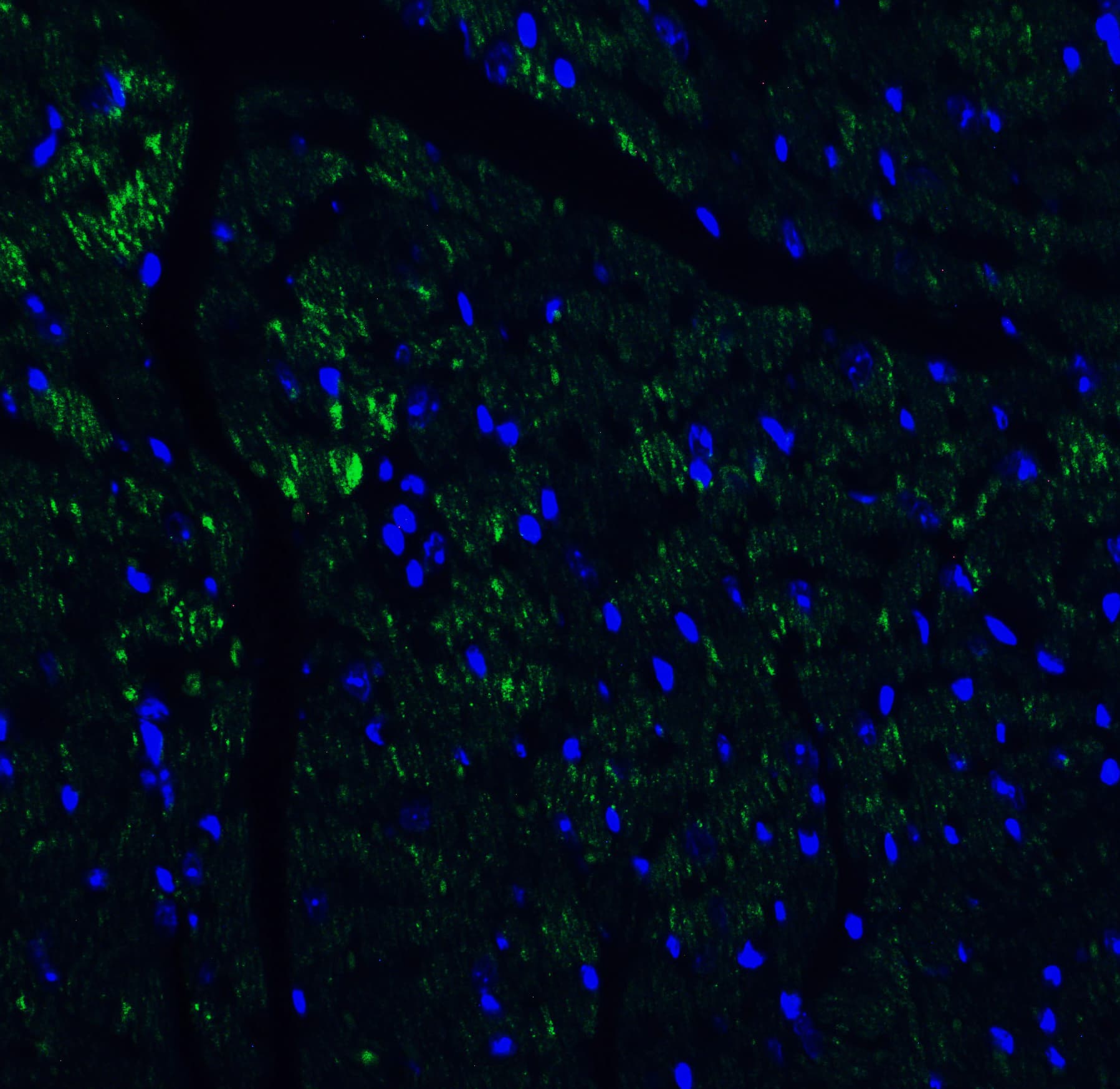 Immunocytochemistry/ Immunofluorescence: IL-17/IL-17A Antibody - BSA Free [NBP1-76337] - Validation of IL-17/IL-17A in Mouse Heart Tissue.Immunofluorescent analysis of 4% paraformaldehyde-fixed mouse heart issue labeling IL-17/IL-17A with at 10 ug/mL, followed by goat anti-rabbit IgG secondary antibody at 1/500 dilution (green) and DAPI staining (blue).    