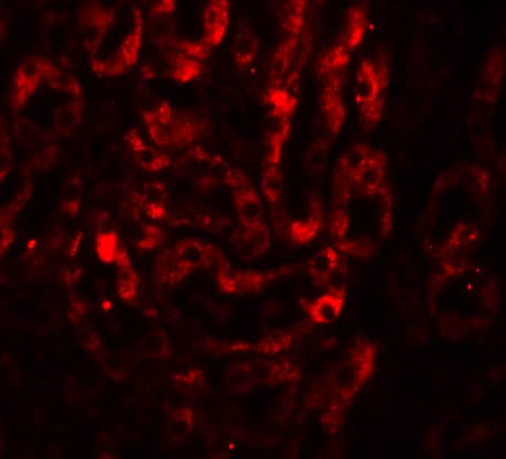 Immunocytochemistry/ Immunofluorescence: IL-17/IL-17A Antibody - BSA Free [NBP1-76337] - Validation of IL-17/IL-17A in Mouse Thymus Tissue.Immunofluorescent analysis of 4% paraformaldehyde-fixed mouse thymus tissue labeling IL-17/IL-17A with  at 20 ug/mL, followed by goat anti-rabbit IgG secondary antibody at 1/500 dilution (red).