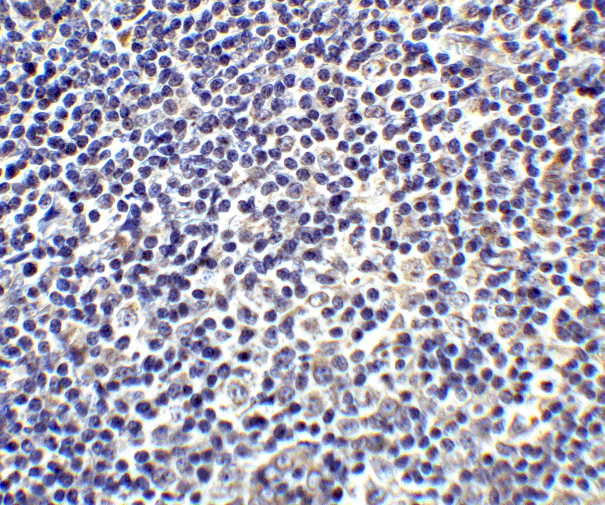 Immunohistochemistry: IL-17/IL-17A Antibody - BSA Free [NBP1-76337] - Validation of IL-17/IL-17A in Human Tonsil Tissue.Immunohistochemical analysis of paraffin-embedded human tonsil tissue using anti-IL-17/IL-17A antibody  at 5 ug/mL. Tissue was fixed with formaldehyde and blocked with 10% serum for 1 h at RT; antigen retrieval was by heat mediation with a citrate buffer (pH6). Samples were incubated with primary antibody overnight at 4C. A goat anti-rabbit IgG H&L (HRP) at 1/250 was used as secondary. Counter stained with Hematoxylin.