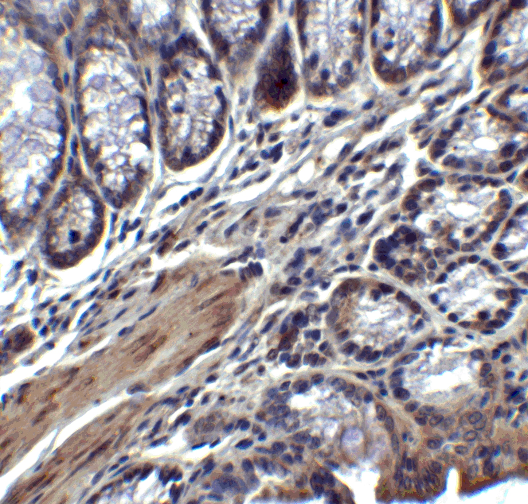 Immunohistochemistry: IL-17/IL-17A Antibody - BSA Free [NBP1-76337] - Validation of IL-17/IL-17A in Mouse Colon Tissue.  Immunohistochemical analysis of paraffin-embedded mouse colon tissue using anti-IL-17/IL-17A antibody  at 2 ug/mL. Tissue was fixed with formaldehyde and blocked with 10% serum for 1 h at RT; antigen retrieval was by heat mediation with a citrate buffer (pH6). Samples were incubated with primary antibody overnight at 4C. A goat anti-rabbit IgG H&L (HRP) at 1/250 was used as secondary. Counter stained with Hematoxylin.