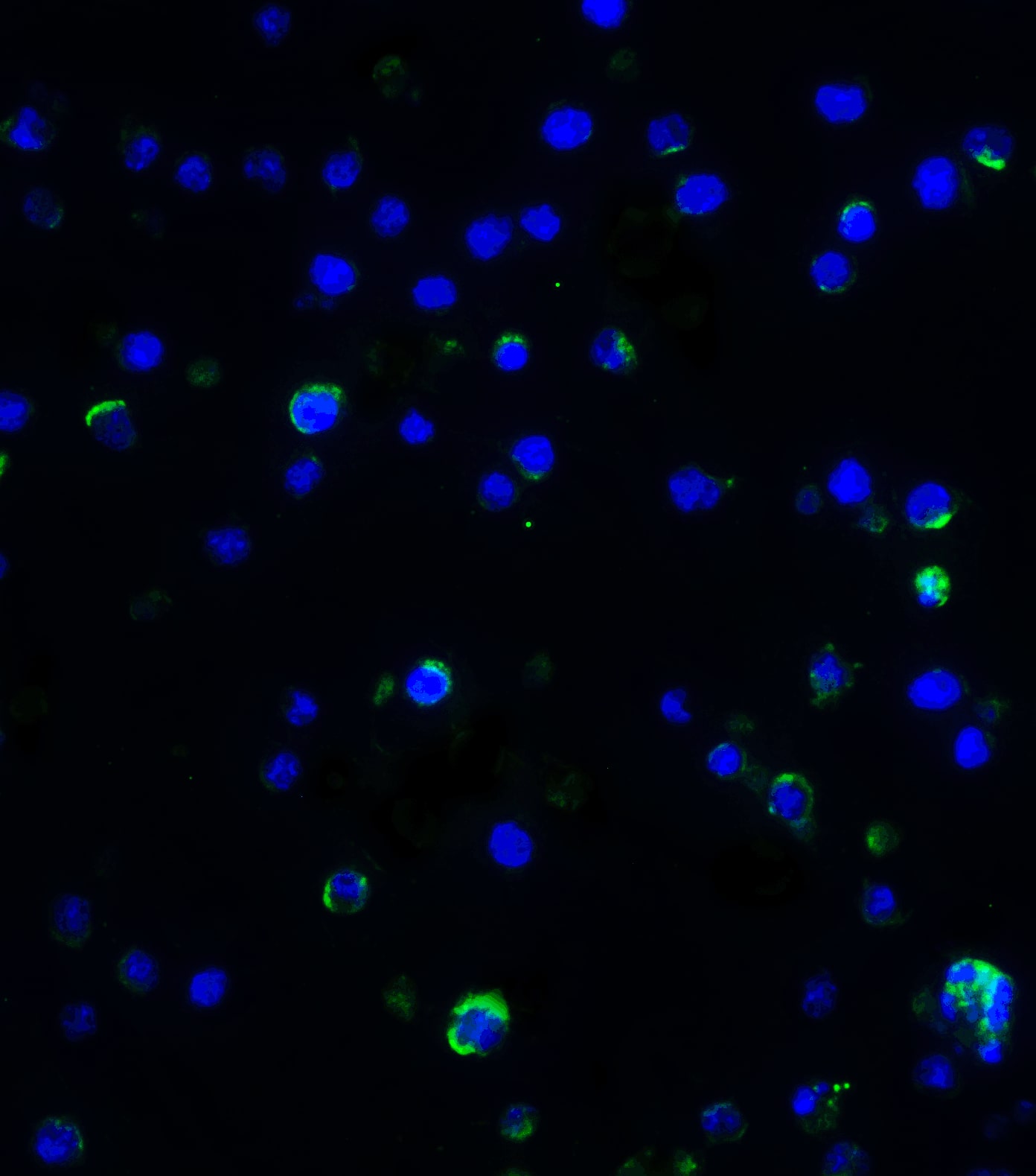 Immunocytochemistry/ Immunofluorescence: IL-17/IL-17A Antibody - BSA Free [NBP1-76337] - Validation of IL-17/IL-17A in Mouse A-20 Cells.Immunofluorescent analysis of 4% paraformaldehyde-fixed mouse A-20 Cells labeling IL-17/IL-17A with  at 5 ug/mL, followed by goat anti-rabbit IgG secondary antibody at 1/500 dilution (green) and DAPI staining (blue).    