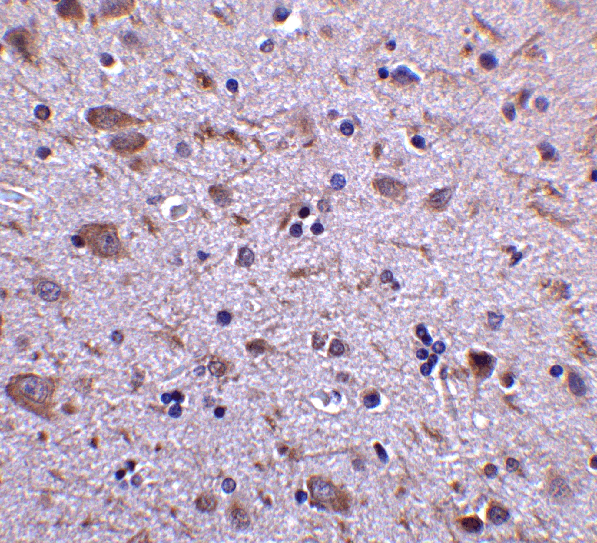 Immunohistochemistry: IRGM Antibody - BSA Free [NBP1-76377] - Immunohistochemistry of CD4 in human thymus tissue with CD4 antibody at 5 u/ml.