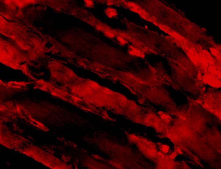 Immunocytochemistry/ Immunofluorescence: IL-31 Antibody - BSA Free [NBP1-76419] - Immunofluorescence of IL-31 in Human Skeletal Muscle cells with IL-31 antibody at 20 ug/mL.