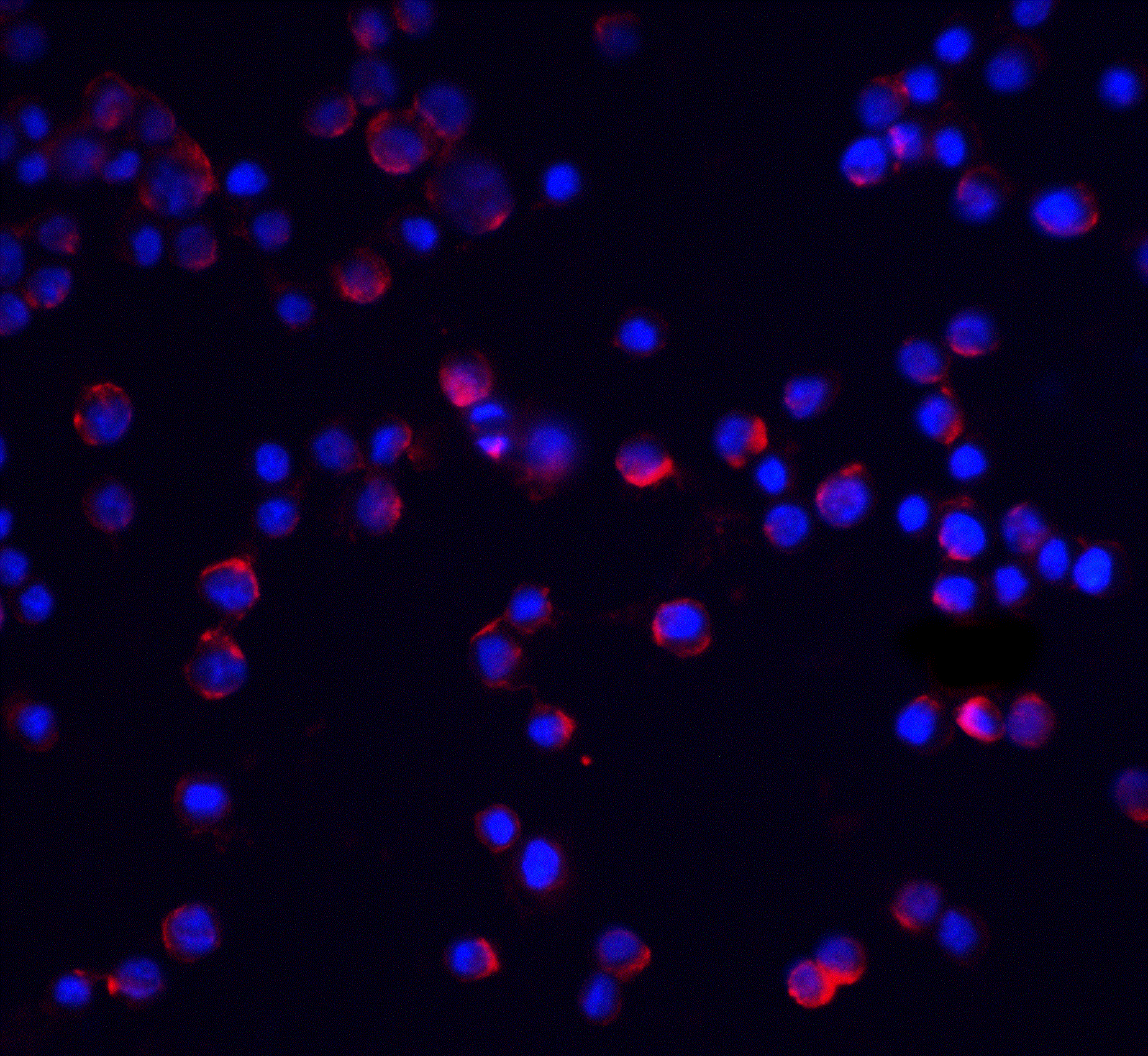 Immunocytochemistry/ Immunofluorescence: IL-1 RAcP/IL-1 R3 Antibody - BSA Free [NBP1-76464] - Immunofluorescence of IL-1 RAcP/IL-1 R3 in HeLa cells with IL-1 RAcP/IL-1 R3 antibody at 5 ug/mL.Red: IL-1 RAcP/IL-1 R3 Antibody   Blue: DAPI staining