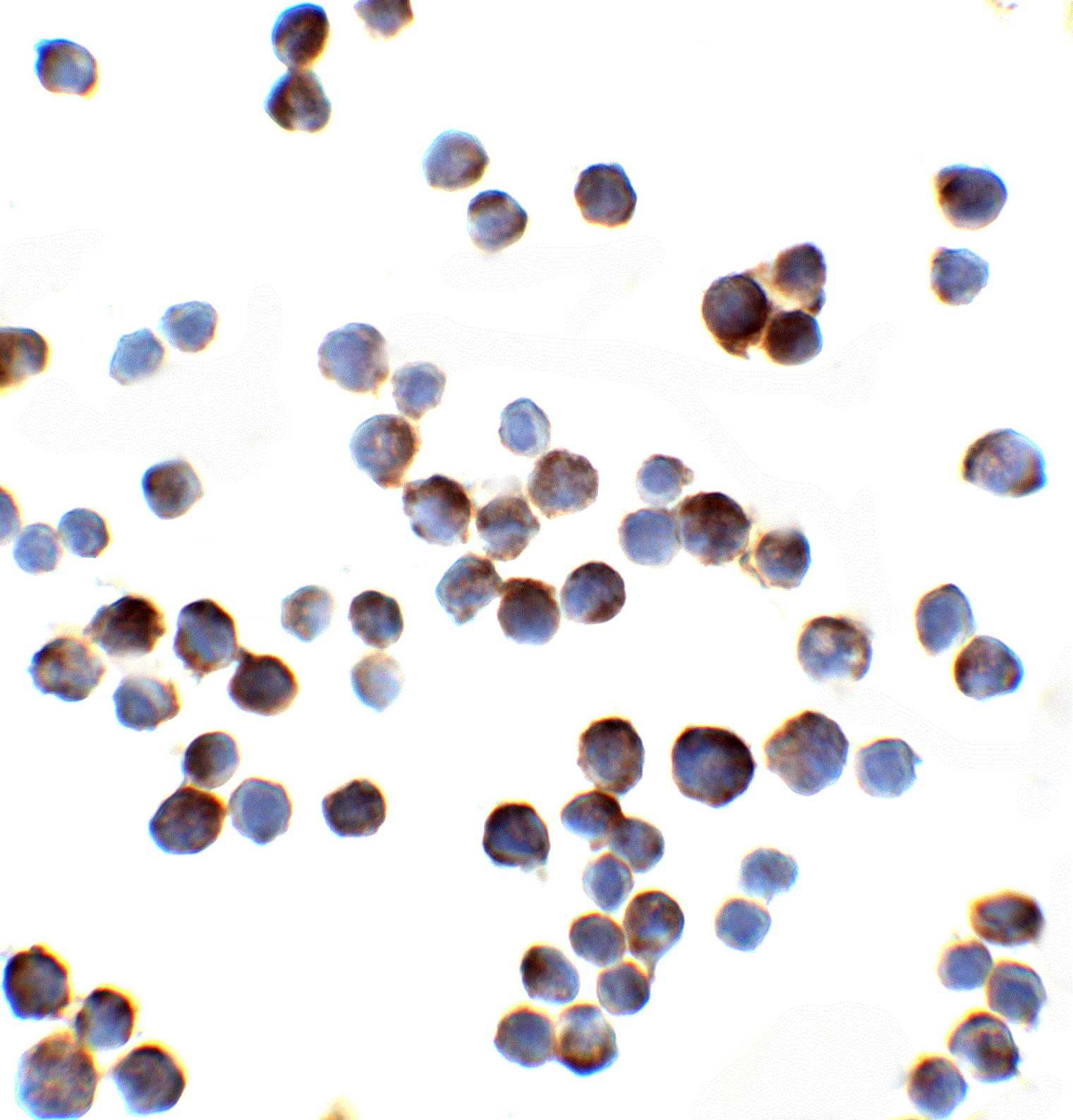 Immunocytochemistry/ Immunofluorescence: IL-1 RAcP/IL-1 R3 Antibody - BSA Free [NBP1-76464] - Immunocystochemistry of IL-1 RAcP/IL-1 R3 in HeLa cells with IL-1 RAcP/IL-1 R3 antibody at 2 ug/ml.