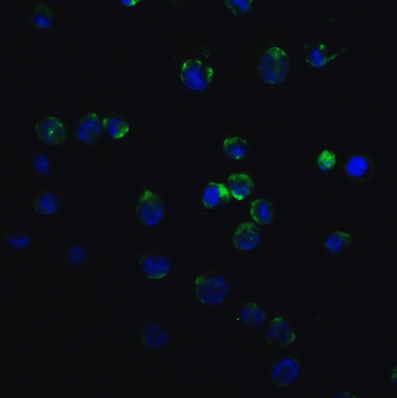 Immunocytochemistry/ Immunofluorescence: MyD88 Antibody - BSA Free [NBP1-76465] - Validation of MyD88 in K562 Cells. Immunofluorescent analysis of 4% paraformaldehyde-fixed K562 cells labeling MyD88 with  at 20 ug/mL, followed by goat anti-rabbit IgG secondary antibody at 1/500 dilution (green) and DAPI staining (blue). 