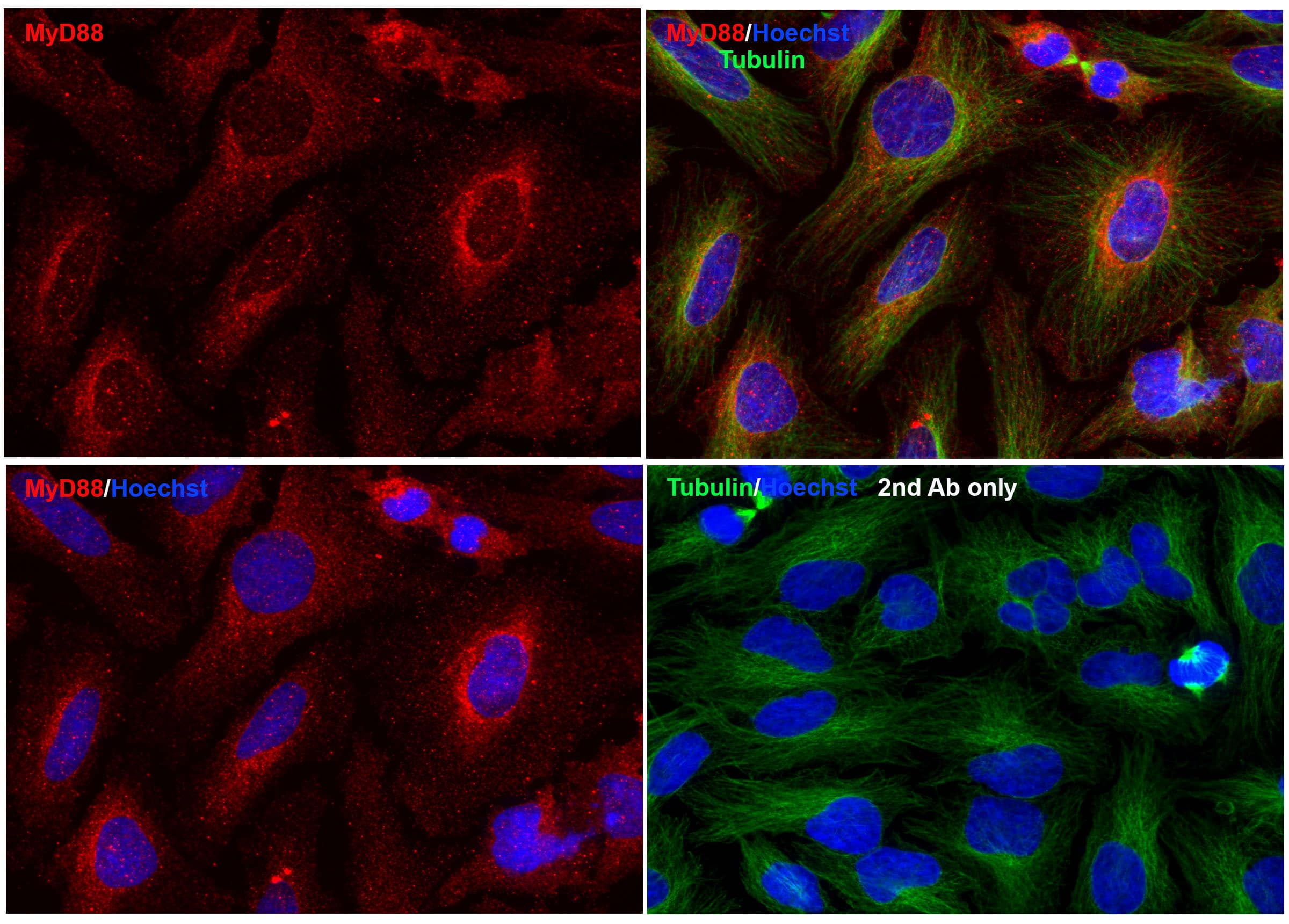 Immunocytochemistry/ Immunofluorescence: MyD88 Antibody - BSA Free [NBP1-76465] - Validation of MyD88 In HeLa Cells. Immunofluorescent analysis of methanol-fixed HeLa cells labeling MyD88 with  at 20 ug/mL, followed by goat anti-rabbit IgG secondary antibody at 1/1000 dilution (red) and Hoechst staining (blue). Alpha tubulin was stained with anti-alpha tubulin antibody following by goat anti-mouse IgG secondary antibody (green). Images were captured with confocal microscopy.  