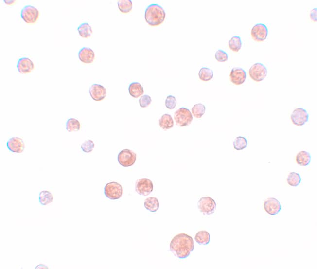 Immunocytochemistry/ Immunofluorescence: PLAC2 Antibody - BSA Free [NBP1-76486] - Immunocytochemistry of PLAC2 in HeLa cells with PLAC2 antibody at 10 u/mL.