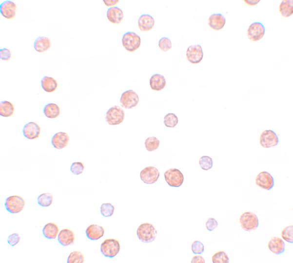 Immunocytochemistry/ Immunofluorescence: Pappalysin-2/PAPP-A2 Antibody - BSA Free [NBP1-76487] - Immunocytochemistry of Pappalysin-2/PAPP-A2 in HeLa cells with Pappalysin-2/PAPP-A2 antibody at 10 u/mL.