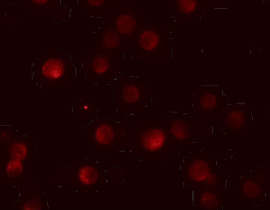 Immunocytochemistry/ Immunofluorescence: Pappalysin-2/PAPP-A2 Antibody - BSA Free [NBP1-76487] - Immunofluorescence of Pappalysin-2/PAPP-A2 in HeLa cells with Pappalysin-2/PAPP-A2 antibody at 20 u/mL.