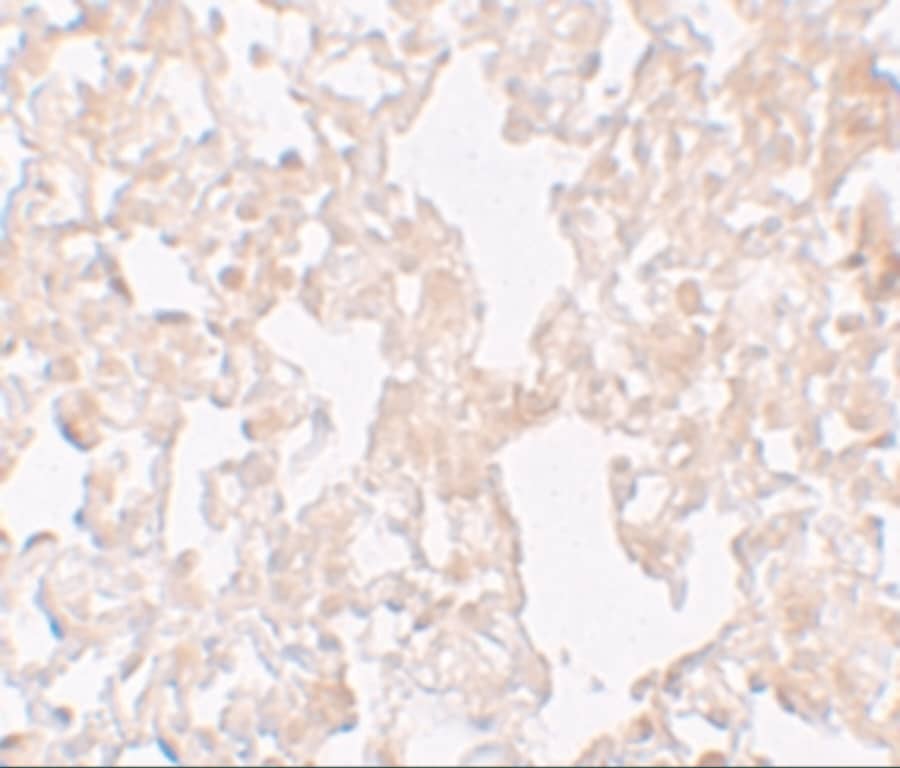 Immunohistochemistry MFSD1 Antibody - BSA Free