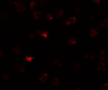 Immunocytochemistry/ Immunofluorescence PIWIL3 Antibody - BSA Free