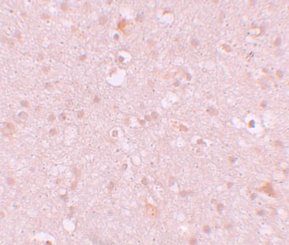 Immunohistochemistry CXXC4 Antibody - BSA Free