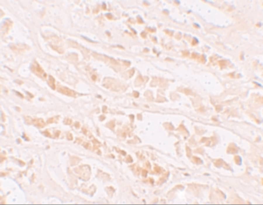 Immunohistochemistry: EFCAB4B Antibody - BSA Free [NBP1-76493] - Immunohistochemistry of EFCAB4B in human kidney tissue with EFCAB4B antibody at 10 u/mL.
