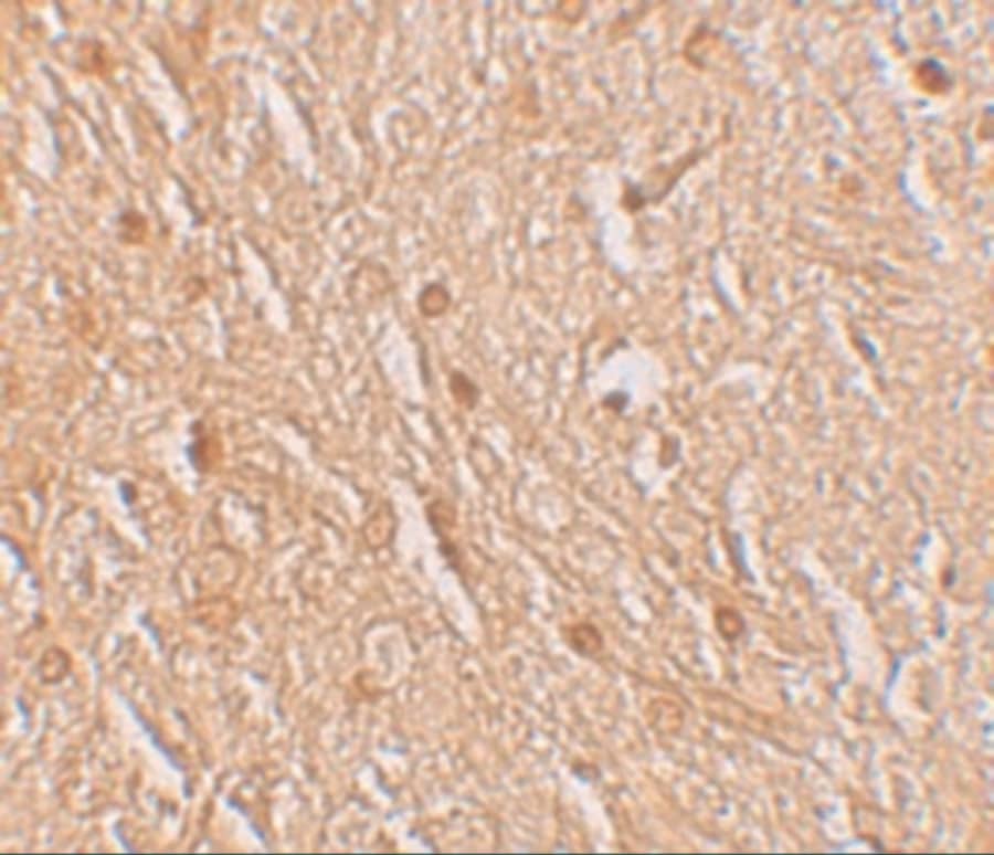 Immunohistochemistry: LMBRD1 Antibody - BSA Free [NBP1-76494] - Immunohistochemistry of LMBRD1 in human brain tissue with LMBRD1 antibody at 2.5 ug/mL.