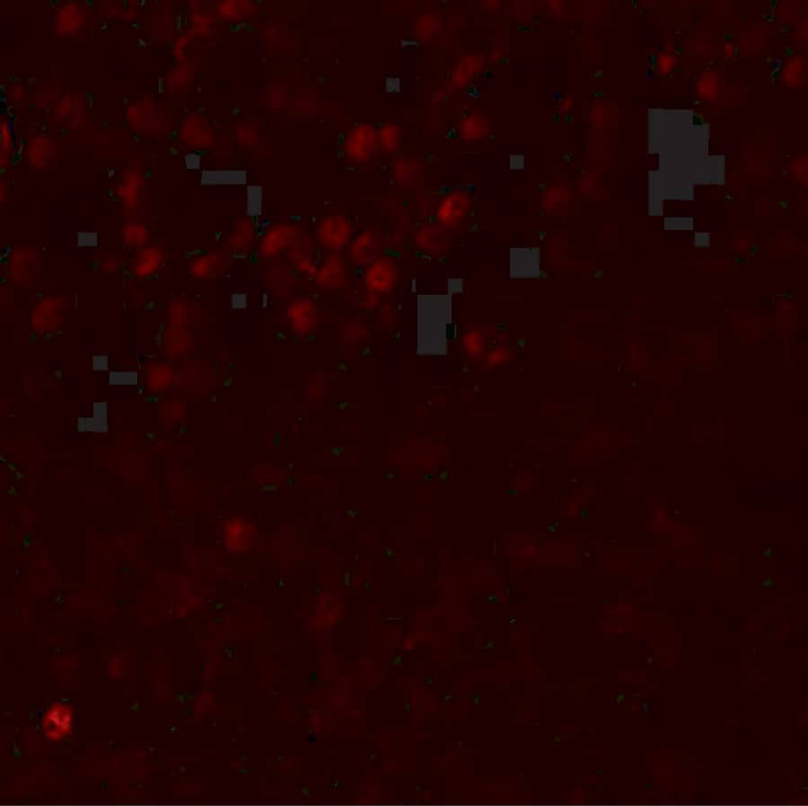 Immunocytochemistry/ Immunofluorescence: LMBRD1 Antibody - BSA Free [NBP1-76494] - Immunofluorescence of LMBRD1 in human brain tissue with LMBRD1 antibody at 20 ug/mL.