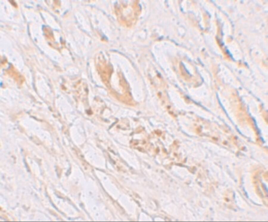 Immunohistochemistry: TMEM59 Antibody - BSA Free [NBP1-76497] - Immunohistochemistry of TMEM59 in human kidney tissue with TMEM59 antibody at 2.5 u/mL.