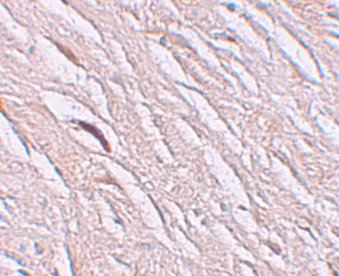 Immunohistochemistry: SLC39A2/ZIP2 Antibody - BSA Free [NBP1-76499] - Immunohistochemistry of SLC39A2/ZIP2 in human brain tissue with SLC39A2/ZIP2 antibody at 2.5 u/mL.