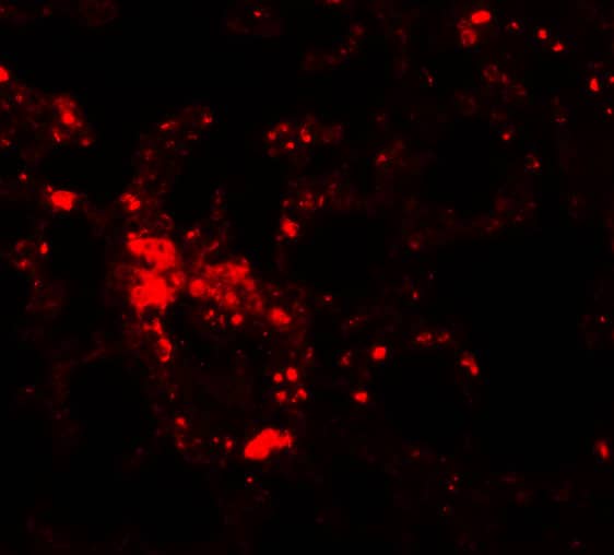 Immunocytochemistry/ Immunofluorescence: LIV-1/Zip6 Antibody - BSA Free [NBP1-76503] - Immunofluorescence of LIV-1/Zip6 in mouse lung tissue with LIV-1/Zip6 antibody at 20 u/mL.