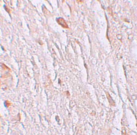 Immunohistochemistry: SLC39A7/ZIP7 Antibody - BSA Free [NBP1-76504] - Figure 6 Immunohistochemistry Validation of SLC39A7/ZIP7 in Human Brain Tissue  Immunohistochemical analysis of paraffin-embedded human brain tissue using anti-SLC39A7/ZIP7 antibody  at 2.5 u/ml. Tissue was fixed with formaldehyde and blocked with 10% serum for 1 h at RT; antigen retrieval was by heat mediation with a citrate buffer (pH6). Samples were incubated with primary antibody overnight at 4C. A goat anti-rabbit IgG H&L (HRP) at 1/250 was used as secondary. Counter stained with Hematoxylin.