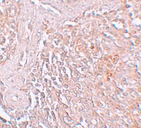 Immunohistochemistry: SLC39A8/ZIP8 Antibody - BSA Free [NBP1-76505] - Immunohistochemistry of SLC39A8/ZIP8 in human spleen tissue with SLC39A8/ZIP8 antibody at 5 u/mL.