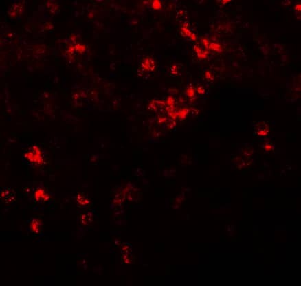 Immunohistochemistry: SLC39A8/ZIP8 Antibody - BSA Free [NBP1-76505] - Immunofluorescence of SLC39A8/ZIP8 in human spleen tissue with SLC39A8/ZIP8 antibody at 20 u/mL.