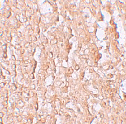 Immunohistochemistry SLC39A10 Antibody - BSA Free