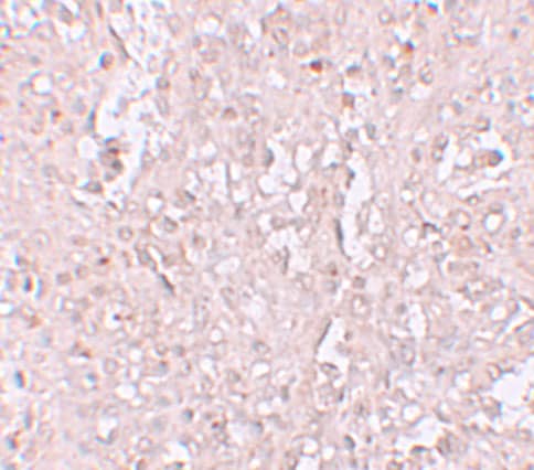 Immunohistochemistry: SLC39A13 Antibody - BSA Free [NBP1-76509] - Immunohistochemistry of SLC39A13 in human spleen tissue with SLC39A13 antibody at 2.5 u/mL.