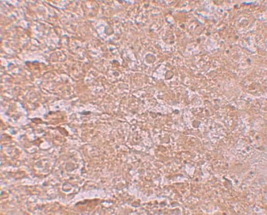 Immunohistochemistry SLC39A14 Antibody - BSA Free