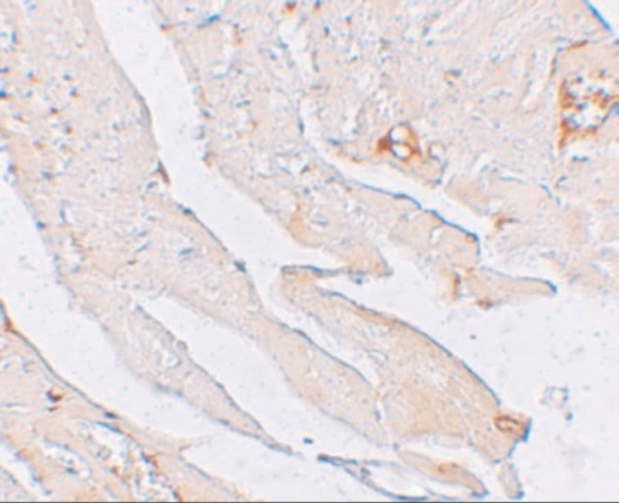 Western Blot: Klotho Antibody - BSA Free [NBP1-76511] - Blockade of the HIF‐1 alpha /p53/miRNA‐34a/Klotho axis decreases the leakage & area of mouse laser‐induced CNV. The mice were divided into the following groups: normal, CNV 7 d, CNV 7 d + 0.1% DMSO, CNV 7 d + digoxin (oral; 2 mg/kg for 7 d), CNV 7 d + AAV‐p53 mutant (intravitreal injection; approximately 3 μL, 3 × 1010 viral particles/mL), CNV 7 d + miRNA‐34a inhibitor (intravitreal injection; 1 μg) & CNV 7 d + AAV‐Klotho full‐length plasmid (intravitreal injection, 2 μL, 5 × 1010 viral particles/mL). A, Western blot was performed to measure HIF‐1 alpha , p‐p53 (S15), p53 (S20), p‐p53 (S46), p53 & Klotho protein levels. B, The relative protein levels of HIF‐1 alpha /GAPDH (B), p‐p53 (S15)/p53 (C), p‐p53 (S20)/p53 (D), p‐p53 (S46)/p53 (E), p53/GAPDH (F) & Klotho/GAPDH (G) were analysed. ***P Figure 4 Immunohistochemistry Validation of Klotho in Mouse Heart Tissue  Immunohistochemical analysis of paraffin-embedded mouse heart tissue using anti-Klotho antibody  at 2.5 u/ml. Tissue was fixed with formaldehyde and blocked with 10% serum for 1 h at RT; antigen retrieval was by heat mediation with a citrate buffer (pH6). Samples were incubated with primary antibody overnight at 4;C. A goat anti-rabbit IgG H&L (HRP) at 1/250 was used as secondary. Counter stained with Hematoxylin.