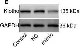 Western Blot: Klotho Antibody - BSA Free [NBP1-76511] - microrna‐34a inhibits the expression of Klotho. ARPE‐19 cells were divided into the following groups: normal, hypoxia, hypoxia + AAV vector, hypoxia + digoxin, hypoxia + digoxin + nutlin‐3a, hypoxia + AAV‐p53 mutant infection & hypoxia + miRNA‐34a inhibitor. A, Western blot assay of Klotho in ARPE‐19 cells was performed. B, The relative protein level of Klotho compared with the GAPDH level was analysed. ***P < .001, hypoxia group vs normal group. ###P < .001, ##P < .01, compared with the hypoxia group. %%P < .01, hypoxia + digoxin + nutlin‐3a group vs hypoxia + digoxin group. C, Schematic of the Klotho 3' UTR with the WT or mutated putative‐binding site of miRNA‐34a inserted into a luciferase (Luc) reporter. D, qRT‐PCR analysis of Klotho mRNA expression in HEK293T cells transfected with miRNA‐34a mimic for 24 h. **P < .01, miRNA‐34a mimic group vs control group. E, Western blot of Klotho in HEK293T cells transfected with a miRNA‐34a mimic for 24 h was performed. F, Immunoblotted Klotho was quantified & normalized to GAPDH. ***P < .001, miRNA‐34a mimic group vs control group. G Relative luciferase activity was detected in HEK293T cells co‐transfected with plasmids containing firefly luciferase & wild‐type (WT) or mutant (Mut) Klotho 3′‐UTR & miRNA‐34a mimic for 24 h. The luciferase activity values were normalized to Renilla reniformis luciferase (TK‐RL) activity. **P < .01, Luc‐Klotho 3′ UTR WT group vs vector group. Statistically non‐significant (NS), Luc‐Klotho 3′ UTR mutant group vs vector group Image collected & cropped by CiteAb from the following publication (//pubmed.ncbi.nlm.nih.gov/33438362), licensed under a CC-BY license. Not internally tested by Novus Biologicals.