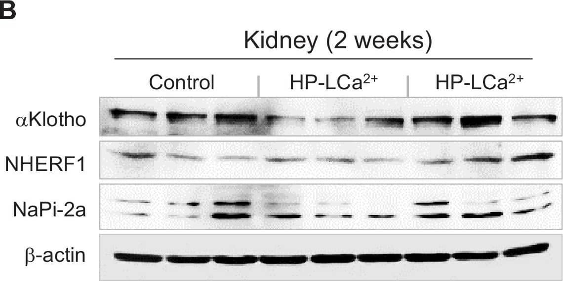 Western Blot: Klotho Antibody - BSA Free [NBP1-76511] - High phytate-induced renal phosphate wasting is independent of FGF23.(A) The renal expression of downregulated genes associated with Ca2+ & phosphate homeostasis in rats fed control or phytate-supplemented diets (n = 8 per group). (B) Results of immunoblot analyses & protein levels of renal aKlotho, NHERF1, & NaPi-2a after 2 weeks for rats fed control, HP- LCa2+ , & HP-HCa2+ diets. (C) The levels of renal proteins were quantified using ImageJ software (n = 6 per group). (D, E) Time course analysis of serum levels of intact FGF23 (D) & C-terminal FGF23 (E) in rats fed control, HP-LCa2+ , & HP-HCa2+ diets. (F) Representative immunohistochemical staining of EDTA-decalcified femur sections for FGF23 from rats fed control, HP-LCa2+ , & HP-HCa2+ diets. All data are presented as the mean ± SD of each group (n = 3–8 per group). *, p<0.05; **, p<0.01; ***, p<0.001, compared with controls. Image collected & cropped by CiteAb from the following publication (//pubmed.ncbi.nlm.nih.gov/32271147), licensed under a CC-BY license. Not internally tested by Novus Biologicals.