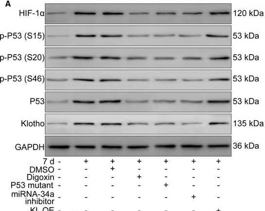 Western Blot: Klotho Antibody - BSA Free [NBP1-76511] - Blockade of the HIF‐1 alpha /p53/miRNA‐34a/Klotho axis decreases the leakage & area of mouse laser‐induced CNV. The mice were divided into the following groups: normal, CNV 7 d, CNV 7 d + 0.1% DMSO, CNV 7 d + digoxin (oral; 2 mg/kg for 7 d), CNV 7 d + AAV‐p53 mutant (intravitreal injection; approximately 3 μL, 3 × 1010 viral particles/mL), CNV 7 d + miRNA‐34a inhibitor (intravitreal injection; 1 μg) & CNV 7 d + AAV‐Klotho full‐length plasmid (intravitreal injection, 2 μL, 5 × 1010 viral particles/mL). A, Western blot was performed to measure HIF‐1 alpha , p‐p53 (S15), p53 (S20), p‐p53 (S46), p53 & Klotho protein levels. B, The relative protein levels of HIF‐1 alpha /GAPDH (B), p‐p53 (S15)/p53 (C), p‐p53 (S20)/p53 (D), p‐p53 (S46)/p53 (E), p53/GAPDH (F) & Klotho/GAPDH (G) were analysed. ***P < .001, CNV 7‐d group vs normal group. ##P < .01, compared with the CNV 7‐d group. NS, CNV 7 d + KL OE group vs CNV 7‐d group. H, RT‐PCR was performed to measure the expression of miRNA‐34a. **P < .01, CNV 7‐d group vs normal group. ##P < .01, compared with the CNV 7‐d group. NS, CNV 7 d + KL OE group vs CNV 7‐d group. I, FFA was performed to measure the leakage of CNV. J, The leakage of CNV was analysed. K, ICGA was performed to measure the area of CNV. L, The area of CNV was analysed. **P < .01, ***P < .001, compared with the CNV 7‐d group Image collected & cropped by CiteAb from the following publication (//pubmed.ncbi.nlm.nih.gov/33438362), licensed under a CC-BY license. Not internally tested by Novus Biologicals.