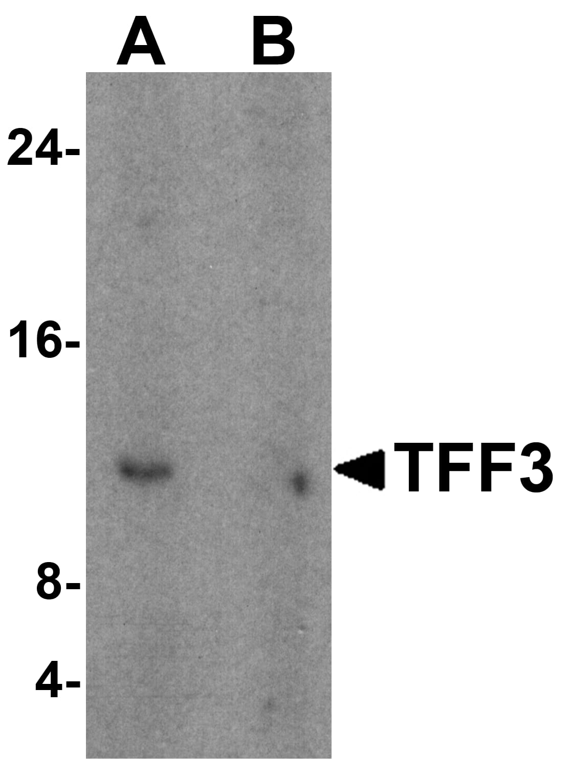 Western Blot: TFF3 Antibody - BSA Free [NBP1-76514] - Western blot analysis of TFF3 in human colon tissue lysate with TFF3 antibody at 1 ug/mL in (A) the absence and (B) the presence of blocking peptide.